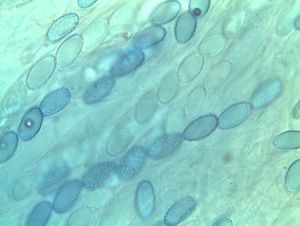 Oušenka kořenující - Sowerbyella radiculata (Sowerby)  Nannf.