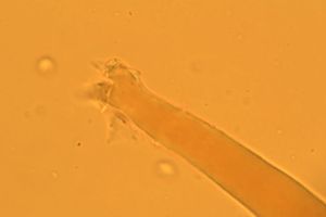 Řasnatka drsnoplodá - Plicaria trachycarpa (Curr.) Boud.