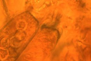 Řasnatka drsnoplodá - Plicaria trachycarpa (Curr.) Boud.