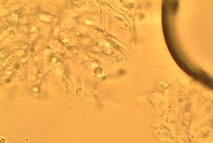 Helmovka vrbová - Mycenella salicina (Velen.) Singer 1951