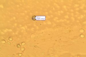 Helmovka vrbová - Mycenella salicina (Velen.) Singer 1951